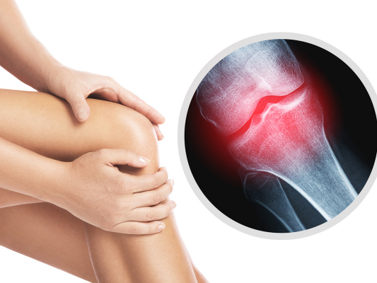 膝の痛みの治し方：専門家が教える効果的なアプローチの画像